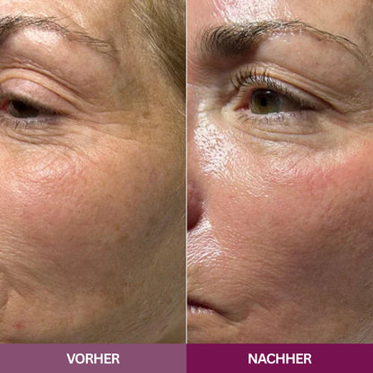 Hyaluron PDRN Orb Serum