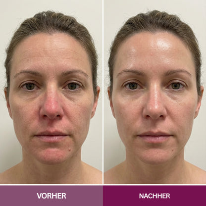 Hyaluron PDRN Orb Serum