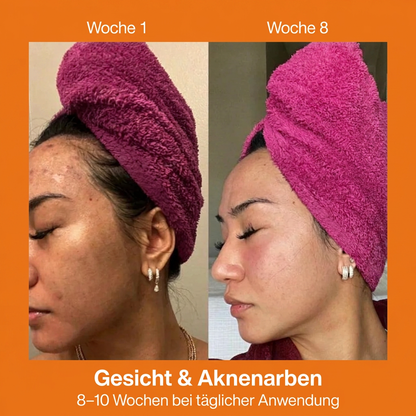 KojiGlow - Kojic Acid Kurkuma Serum Seife